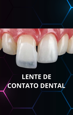 PROTOCOLO TOTAL SOBRE IMPLANTE (11)