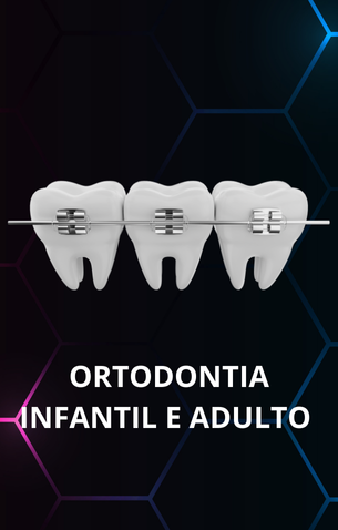 PROTOCOLO TOTAL SOBRE IMPLANTE (5)